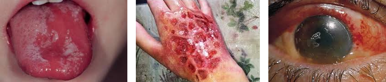 <p>face, eyes, extremities</p>