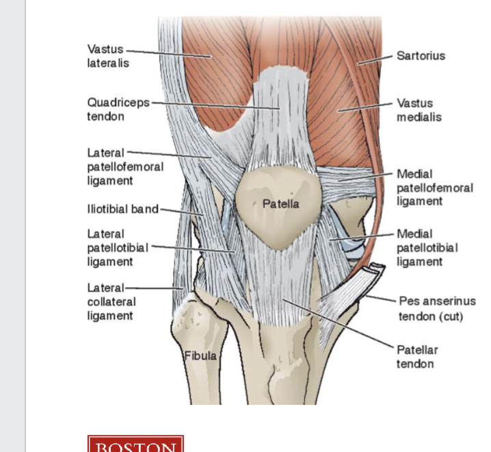 <p><span><strong>Longitudinal stabilizers</strong><br></span><span data-name="black_small_square" data-type="emoji">▪</span><span> Patella tendon<br></span><span data-name="black_small_square" data-type="emoji">▪</span><span> Quad tendon<br></span><span data-name="black_small_square" data-type="emoji">▪</span><span> Patellotibial ligaments<br></span></p><p><span><strong>Transverse stabilizers</strong><br></span><span data-name="black_small_square" data-type="emoji">▪</span><span> Extensor retinaculum<br></span><span data-name="black_small_square" data-type="emoji">▪</span><span> MPFL<br></span><span data-name="black_small_square" data-type="emoji">▪</span><span> Lateral lip of sulcus<br></span><span data-name="black_small_square" data-type="emoji">▪</span><span> Muscle balance</span></p>