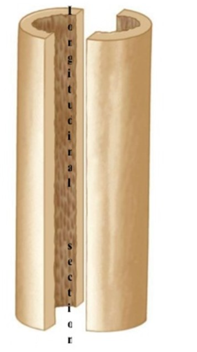 <p>longitudinal cut</p>