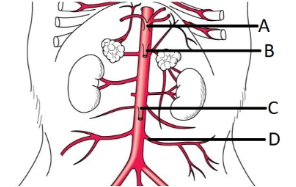 <p><span style="line-height: 17.375px;">Correctly identify the celiac trunk.&nbsp;</span></p>
