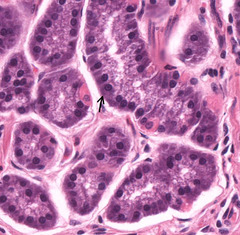 <p>What organelle causes basophilic cytoplasm in this cheif cell?</p>