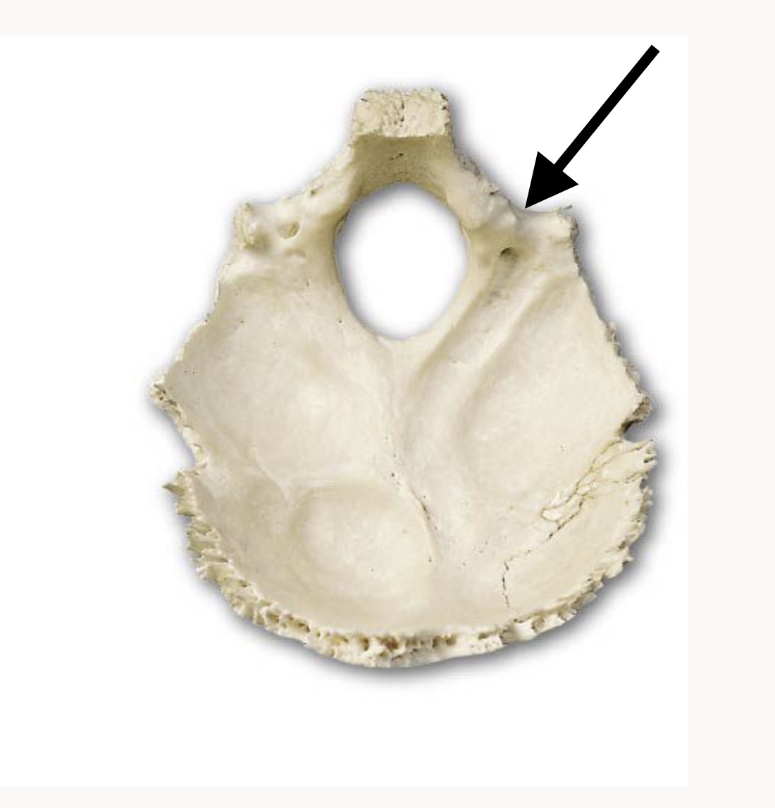 <p>A small bony indentation located on the front edge of the jugular process (half)</p>