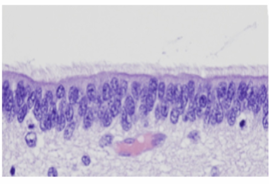 <p><span>Ependymal cells: Function and etc: Line the ventricles and central canal and produce and circulate cerebrospinal fluid (CSF). They are ciliated glial cells and form part of the choroid plexus.</span></p>