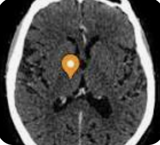 <p>Name the part of the brain, modality, and plane</p>
