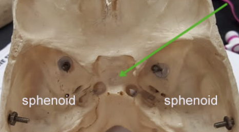 <p>groove/hole in sphenoid bone</p>