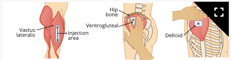 <p>1 to 1 ½ inch needle</p>