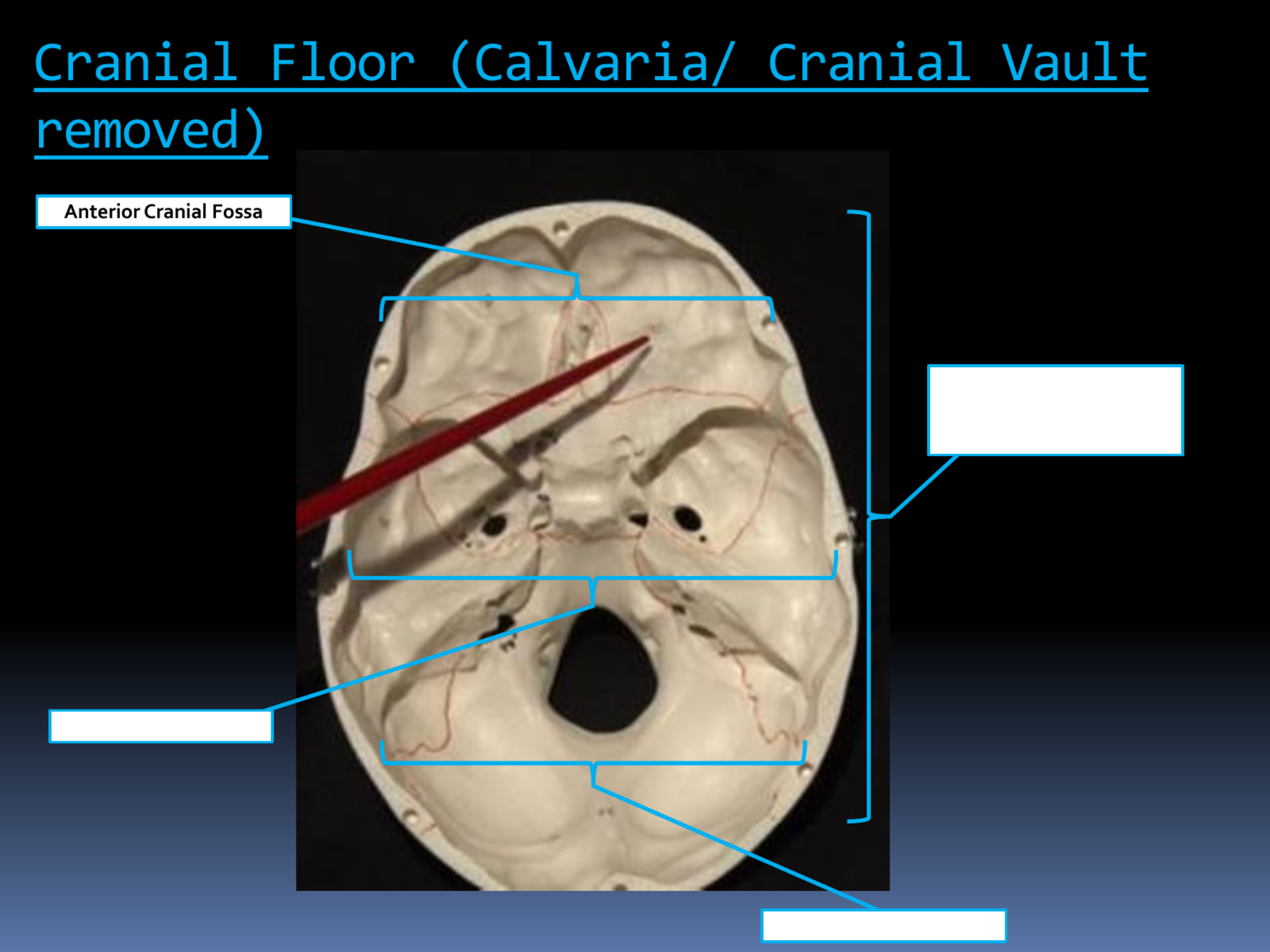 <p>Anterior Cranial Fossa</p>