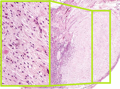 <p>Identify this tissue (What gland); Name a hormone</p>