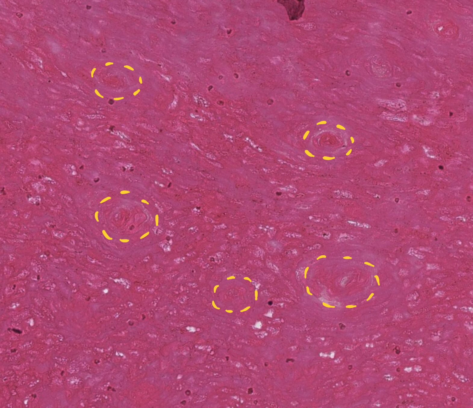 <ul><li><p>thickest layer</p></li><li><p>main structural component → provides strength &amp; stability</p></li><li><p>keratinized tubes surrounded by intertubular horn</p></li></ul><p></p>