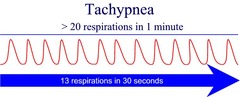 <p>C. tachypnea</p>