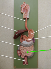 <p>What structure is the green arrow pointing to?</p>