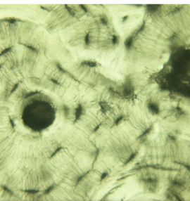 <p>Tissue?</p>