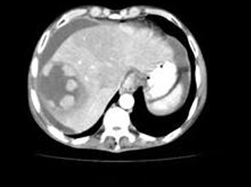 <p>Diagnosis + what phase?</p>