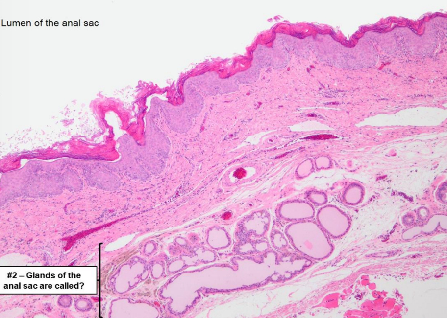 <p>What type of epithelium is shown in the picture?</p>