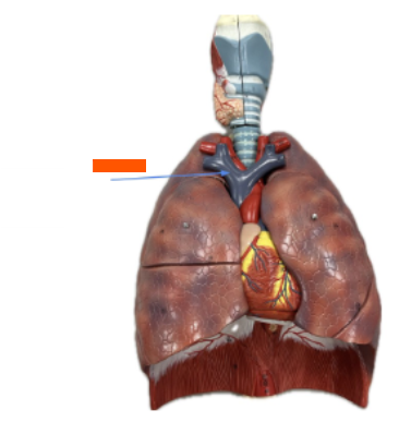 <p>What is the orange arrow?</p>