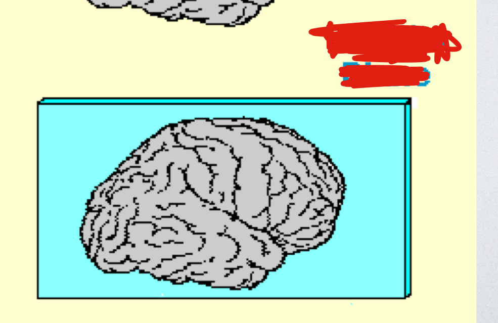 <p>what plane of view for the brain is this?</p>