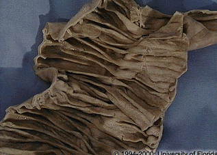 <p>what is the name of the circular mucosal folds found on the internal surface of the jejunum and ileum (as pictured here)?</p>