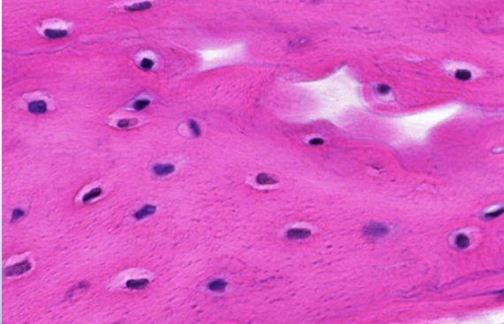 <p>Woven bone is immature bone that is eventually replaced by lamellar bone. It forms rapidly, so cells and collagen fibers are arranged irregularly.</p>