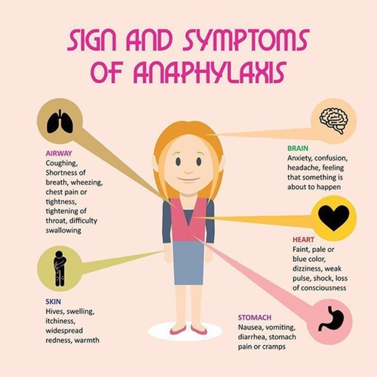 <p>Anaphylaxis.</p>
