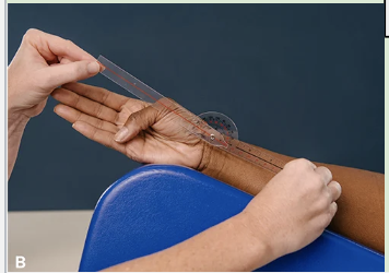 <p>CMC Flexion (Opposition) Typical Range of Motion</p>