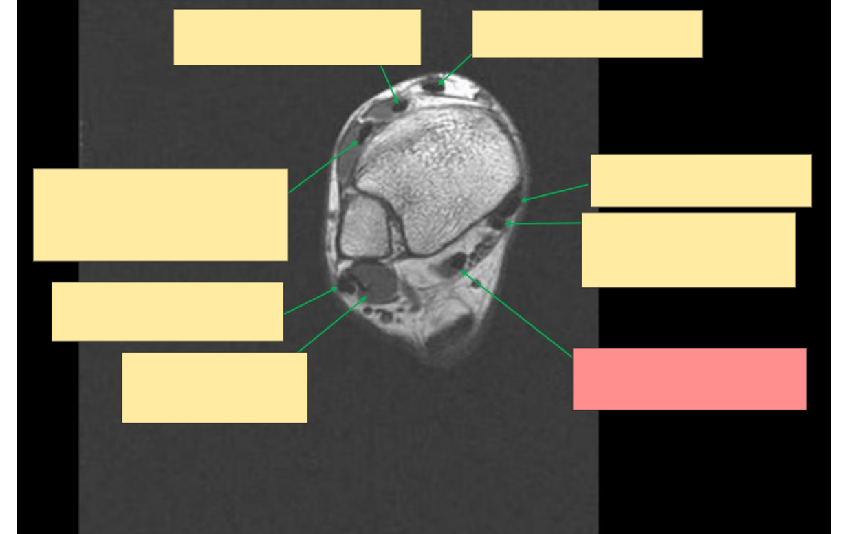 <p>Identify this structure</p>