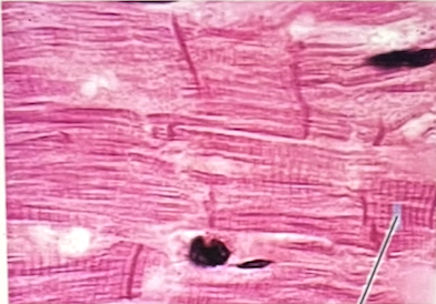 <p>identify the specific muscle tissue</p>