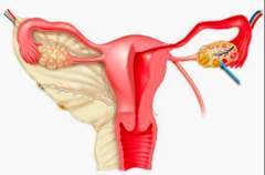 <p>Areas within the ovary in which individual eggs develop</p>