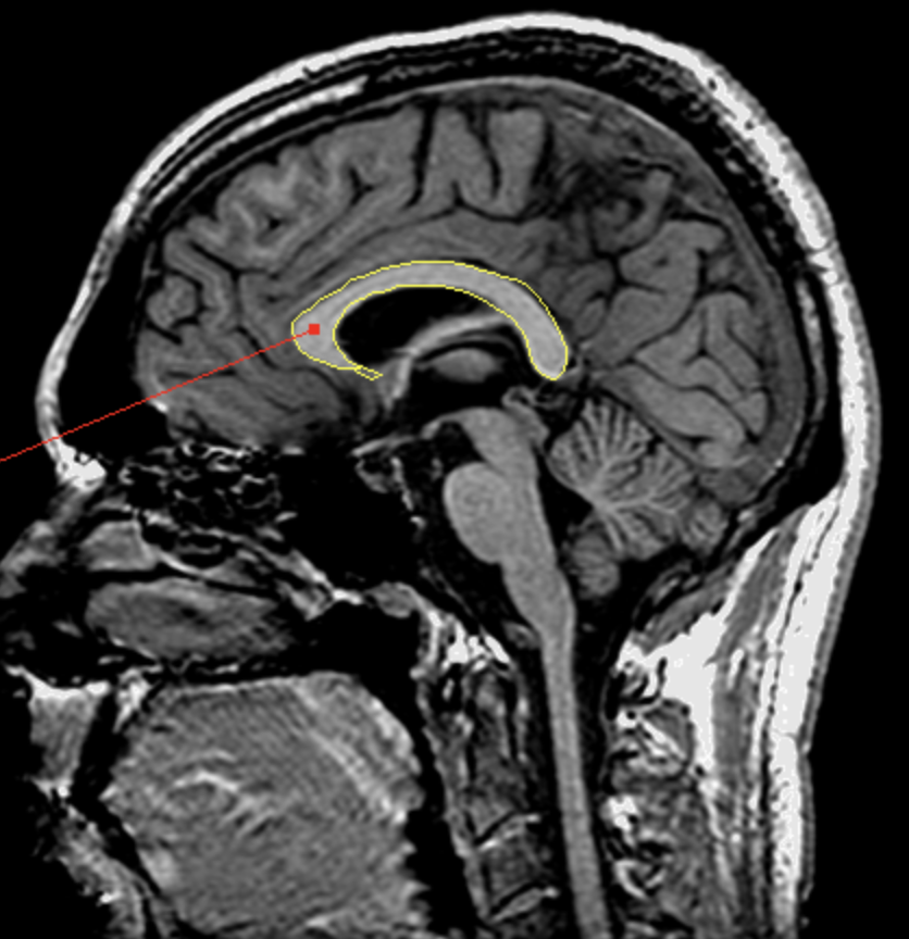 <p>What is the area highlighted called?</p>
