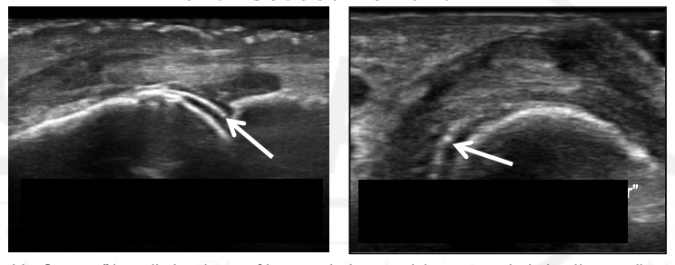 <p>What view is this? What is the arrow?</p>