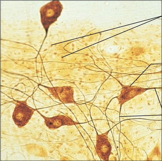 <p>What type of tissue?</p>