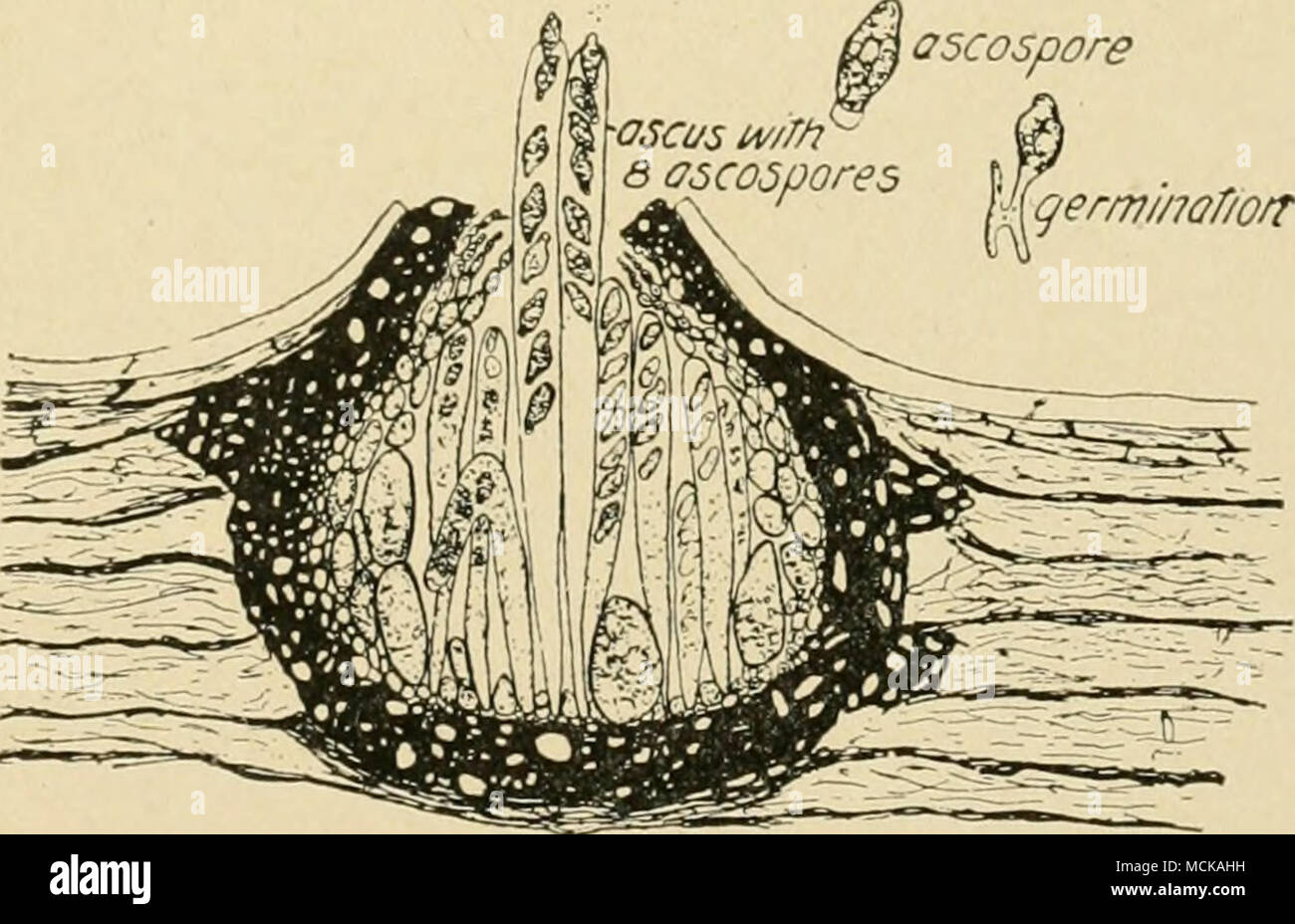 <p>ascospores in asci</p>