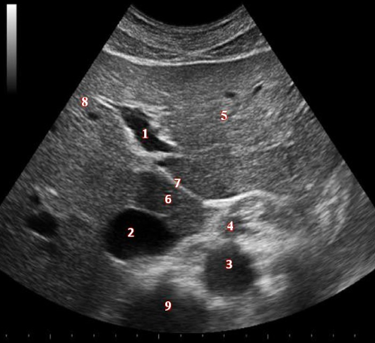 <p>What structure/vessel is indicated by #9?</p><p>a. IVC</p><p>b. aorta</p><p>c. SMA</p><p>d. air within intestines</p><p>e. spine</p>