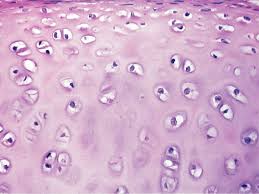 <p>what type of cartilage is this?</p>