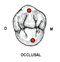 <p>- rounder</p><p>- mesial offset</p>