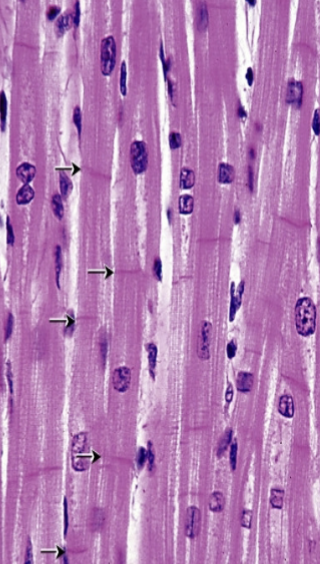 <p>What type of muscle is this?</p>