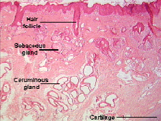 <p>Ceruminous Glands</p>