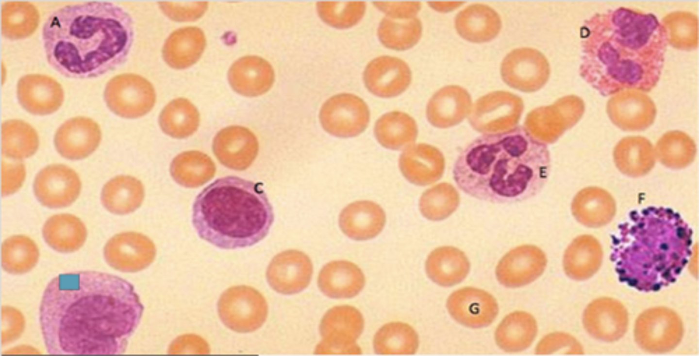 <p>Identify the following blood-formed element</p>