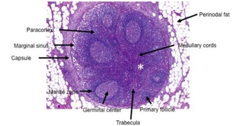 <p>Lymph node structure:</p><p>- primary and secondary follicles</p><p>- Germinal centres</p><p>- Mantle zone</p><p>- Interfollicular zone</p><p>- Contain T and B cells</p><p>.</p><p>- germinal centre is where lot of immunoglobulins are produced</p><p>.</p><ul><li><p>germinal centres: specialized, transient structures formed within secondary lymphoid organs (lymph nodes, spleen, tonsils) during an immune response.</p></li><li><p><span>The mantle zone is </span><strong><mark data-color="rgba(0, 0, 0, 0)" style="background-color: rgba(0, 0, 0, 0); color: inherit;">the outer ring of small, mature B lymphocytes surrounding the germinal center within a secondary lymphoid follicle</mark></strong><span> (e.g., in lymph nodes). It consists of B cells pushed out from the center during activation</span></p></li></ul><p></p>
