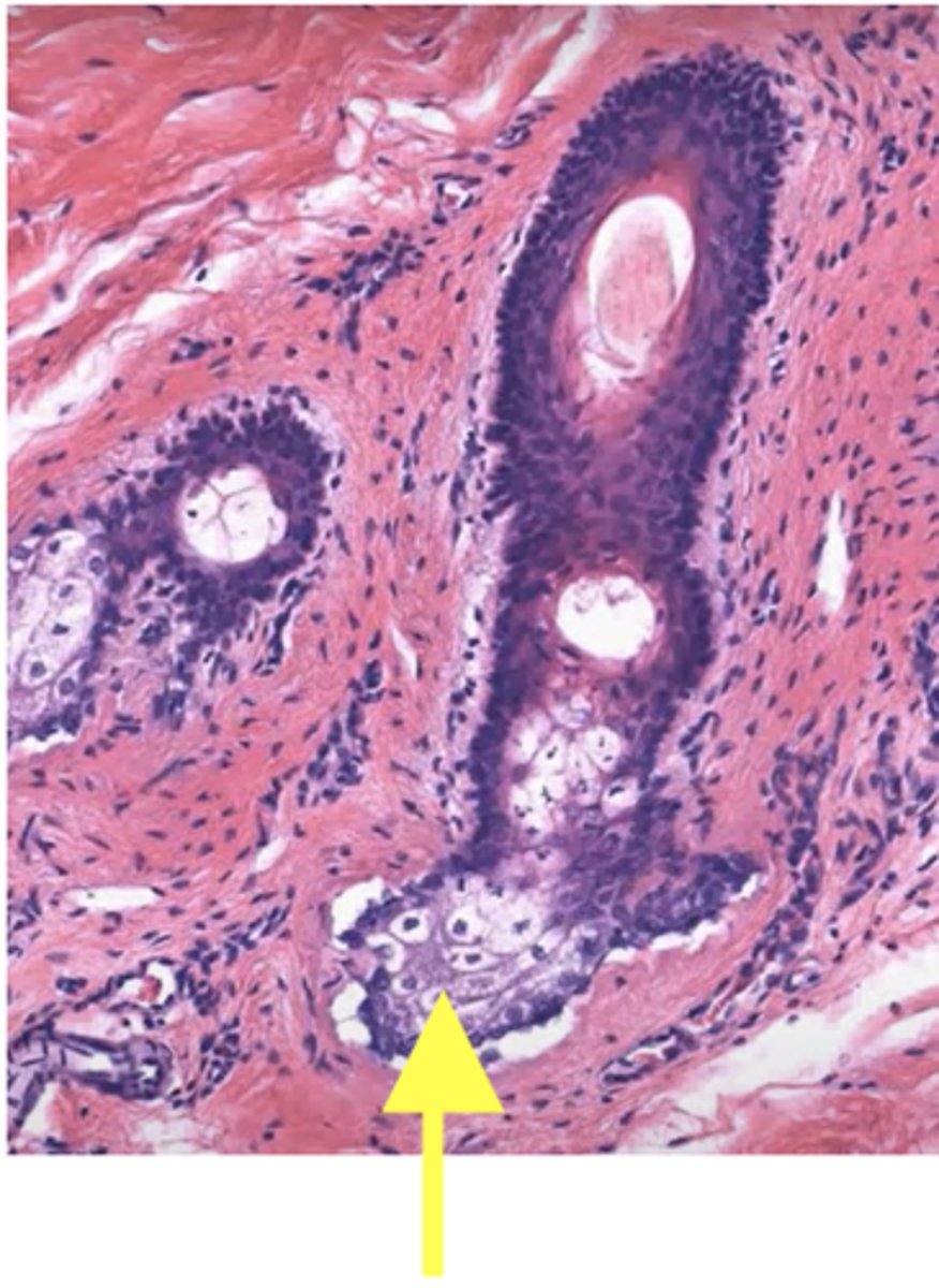 <p>Identify the structure</p>