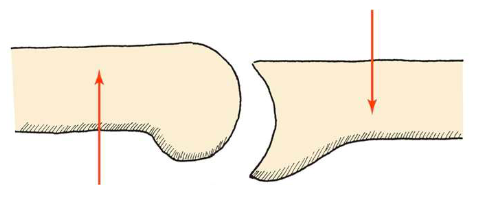 <p>Parallel forces but in opposite directions so if I’m trying to improve glide of joint… I can do a shear (ex. take humerus head and glide it anterior (like jose said) to help with external rotation </p>