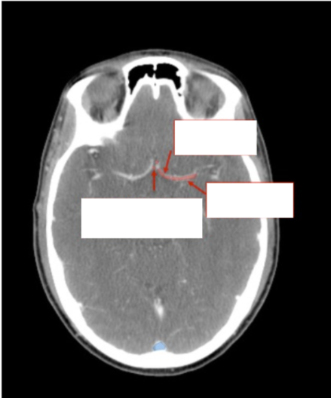 <p>Please label </p>