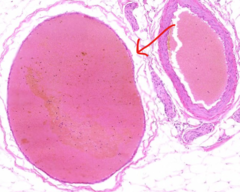 <p>Identify blood vessel type</p>