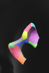 <p>What bony landmark is in dark yellow?</p>