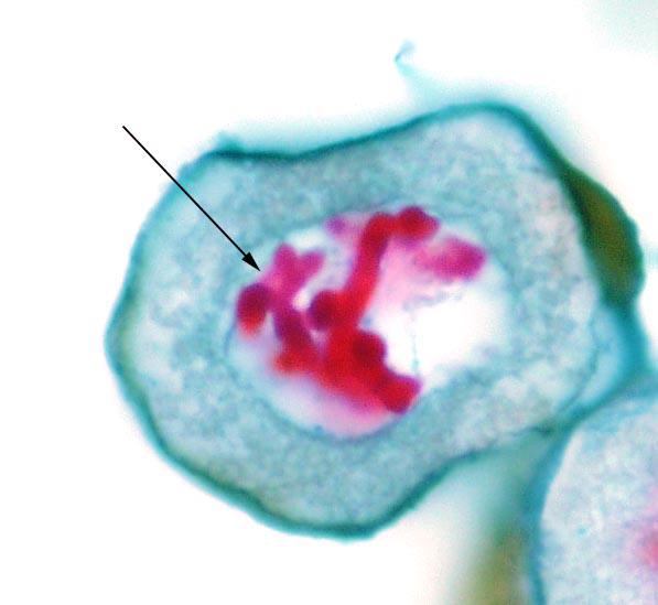 <p>chromosomes condense and thicken; homologous chromosomes cross over and exchange genetic info between each other</p>