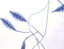 <p>microconidia: rare<br>macroconidia: spindle shaped with thick walls</p>