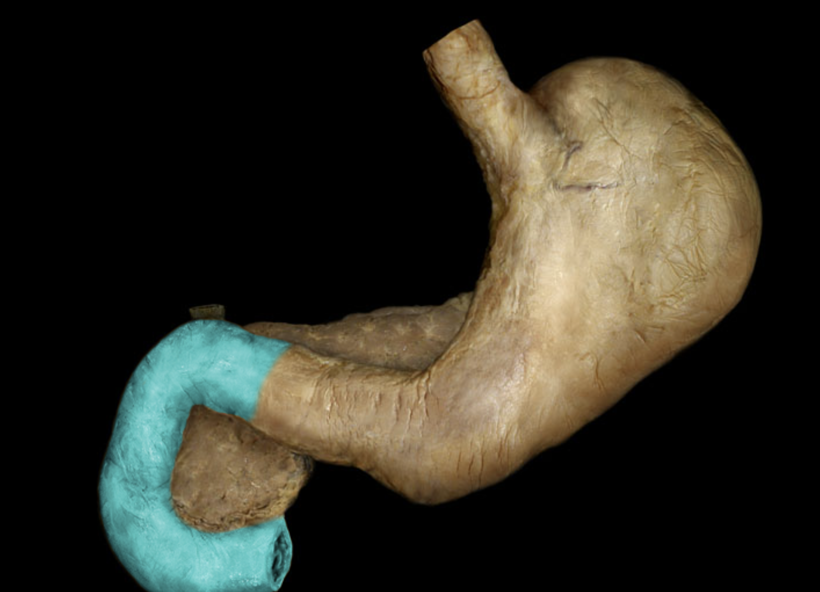 term image