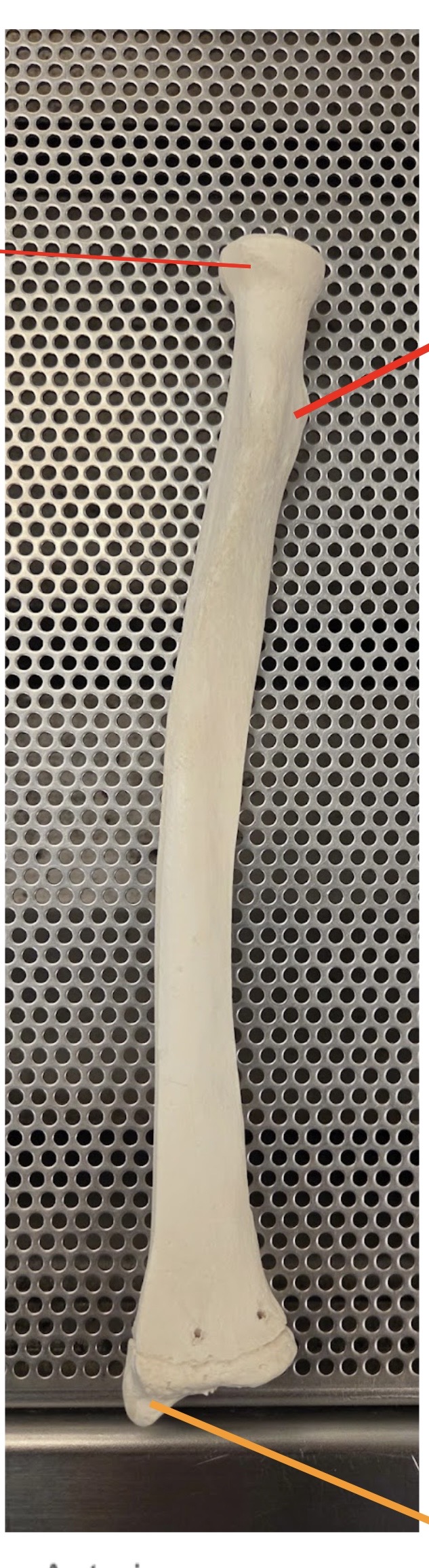 <p>What bone is this?</p>