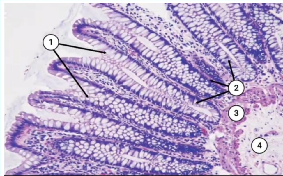 term image