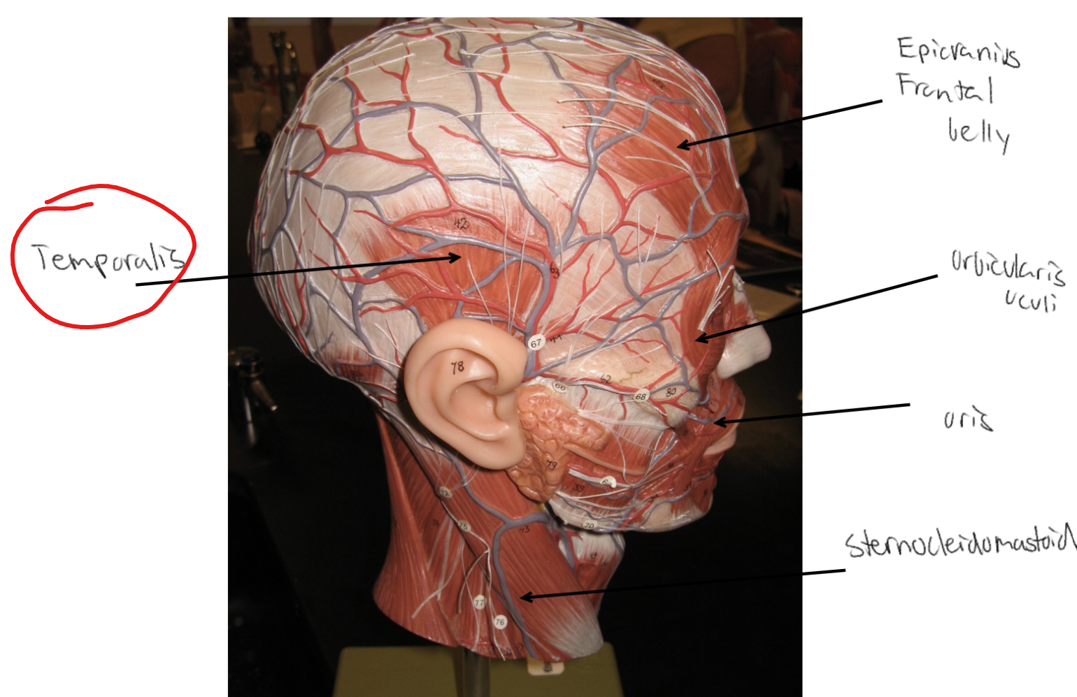 <p>What is the action for the <strong><u>temporalis?</u></strong></p>