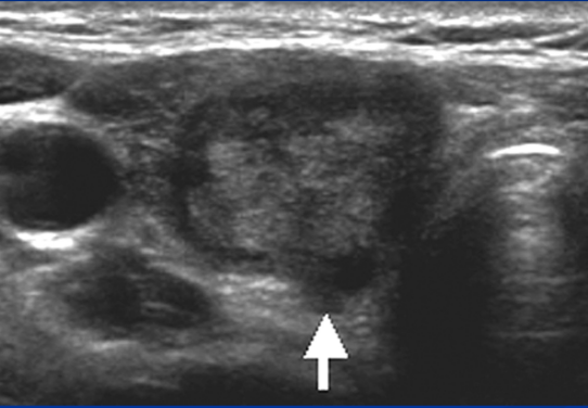 <p>Name the pathology </p>